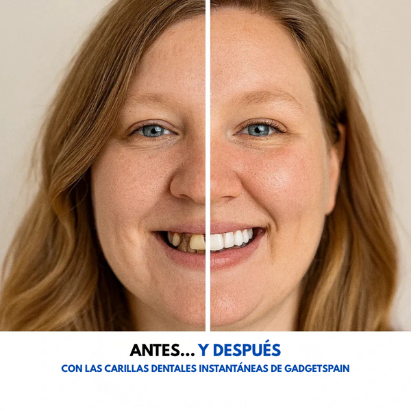 GadgetSpain™ - Carillas Dentales Instantáneas